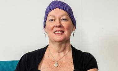 Tái sinh chiếc lưỡi cho người phụ nữ từ da chân